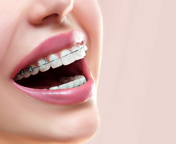 Cullompton Dental & Implant Centre